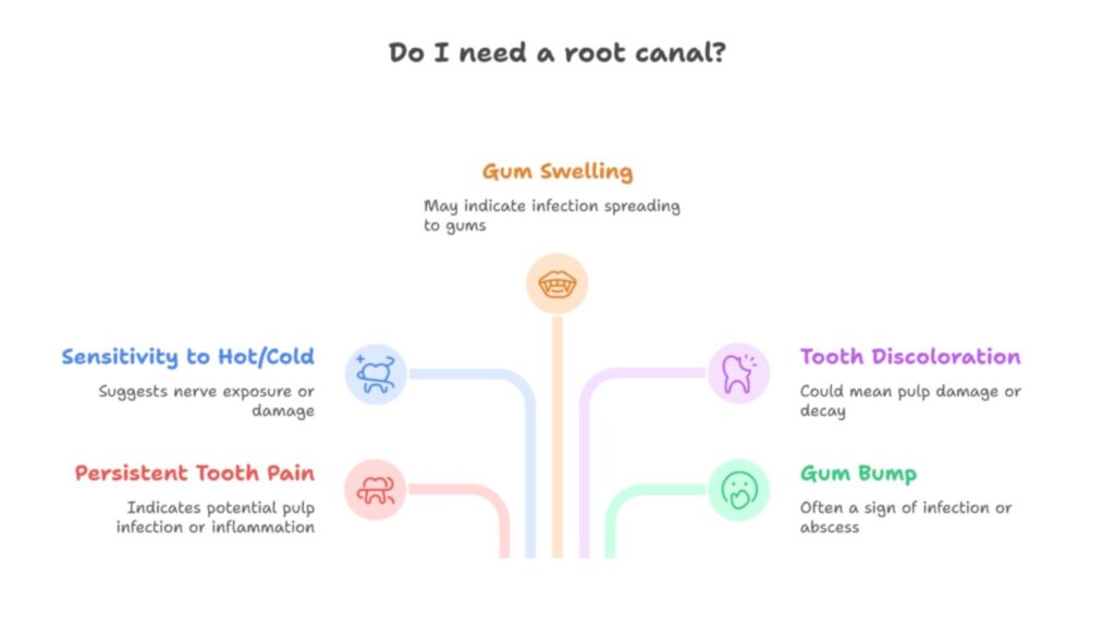 Do I need a root canal?
