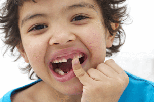 Periodontal Care in Tiruvallur