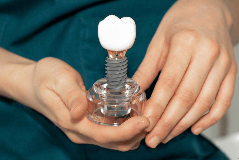 DENTAL IMPLANT