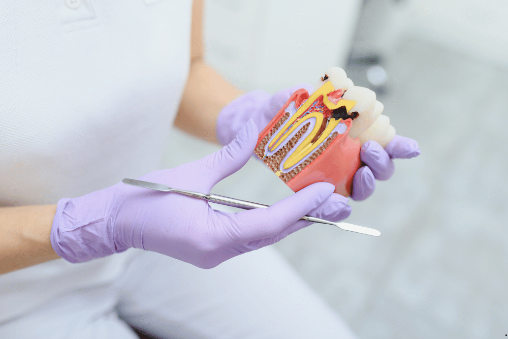 ROOT CANAL TREATMENT