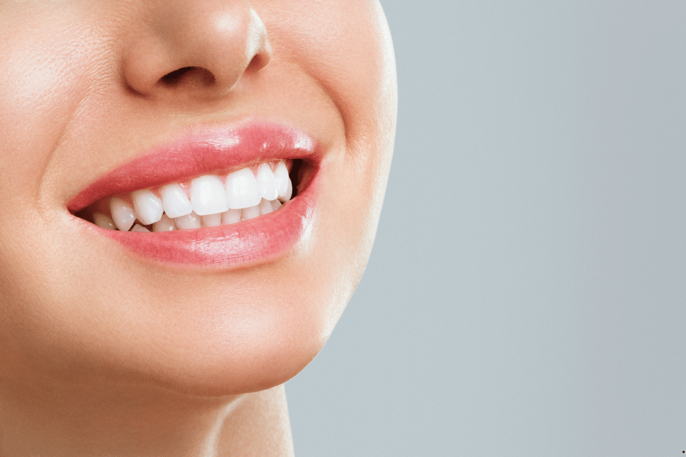 teeth whitenting