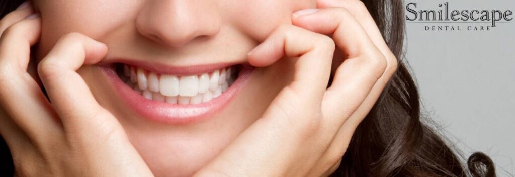 Cosmetic Dentists in Tiruvallur