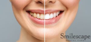 Cosmetic Dentists in Tiruvannamalai