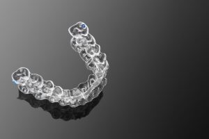 Invisalign in Anna Nagar