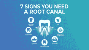 Root Canal Treatment