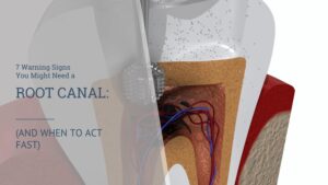 7 warning signs you need root canal treatment in Salem