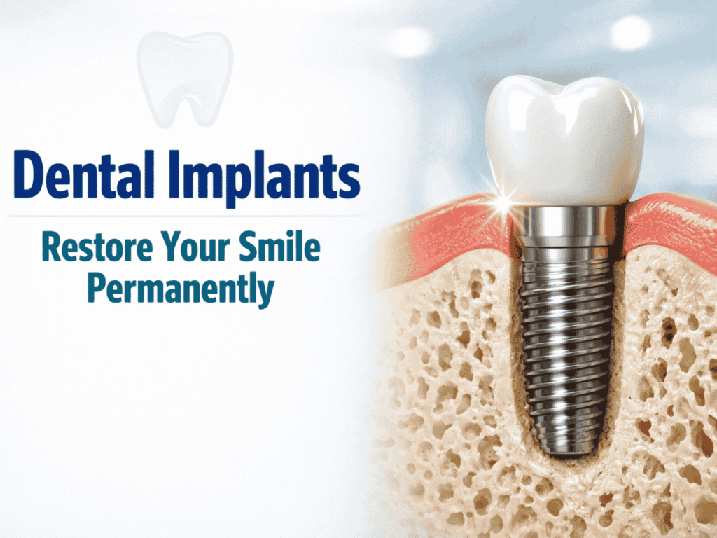 Dental Implants in Tiruvallur