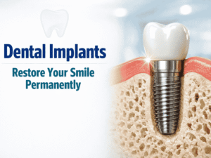 Dental Implants in Salem