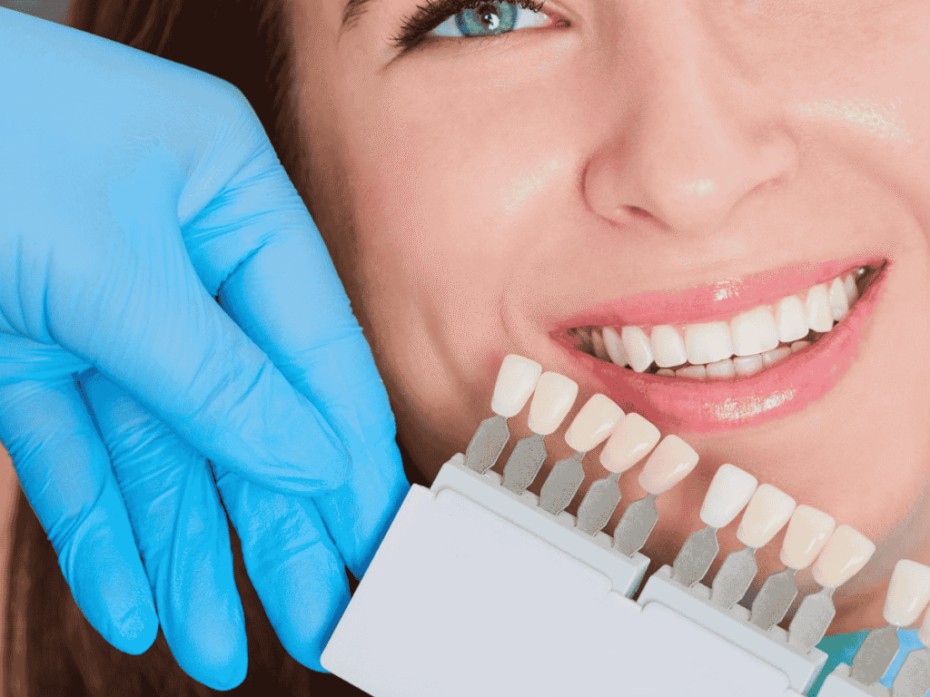 Smile Design