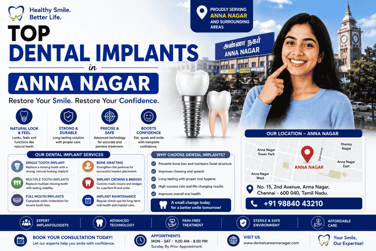 Top Dental Implants in Anna Nagar