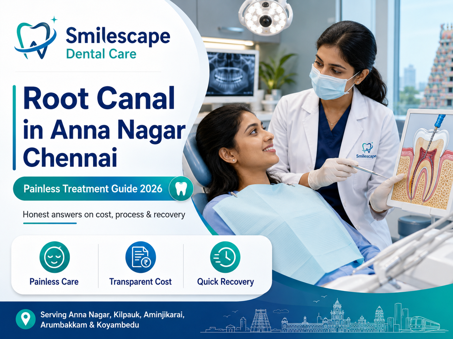 Root Canal in Anna Nagar