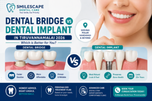 Dental Bridge vs Implant in Tiruvannamalai
